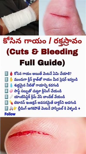 cut wound first aid Telugu, bleeding control Telugu, how to stop bleeding fast Telugu