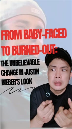 Justin Bieber's Transformation: From Baby Face to Burned Out