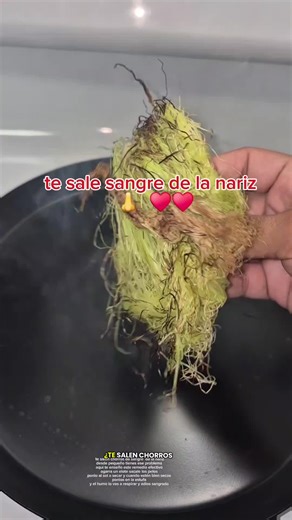 #viral #remedios #remedioscaseros #RemediosEfectivos | Remediosnaturales