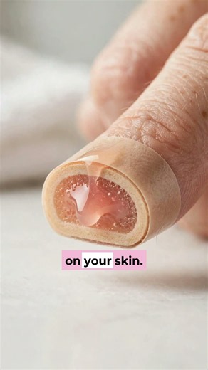 Pimple Patch White Stuff Explained #shorts