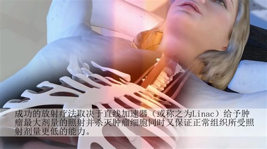 [放疗]直线加速器工作原理 - 中文版