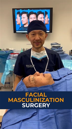 FFS Institute | Facial masculinization surgery is here 🛠️👃 This male transgender patient wanted a stronger jaw and nose. Using a custom 3D implant and rib... | Instagram
