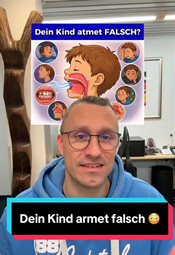 Mundatmung verändert das GANZE Gesicht deines Kindes! 😱👄 Was viele Eltern nicht wissen: Dauerhaft durch den Mund atmen = Gesicht verändert sich! Normal (Nasenatmung): ✅ Zunge oben am Gaumen ✅ Formt Oberkiefer von innen Bei Mundatmung: ❌ Zunge fällt nach unten ❌ Oberkiefer wird SCHMALER ❌ Gaumen wird HÖHER Die Folgen: ⚠️ Platzmangel für Zähne ⚠️ Offener Biss ⚠️ Kreuzbiss ⚠️ Zahnfehlstellungen ⚠️ Schlafstörungen ⚠️ MEHR Karies (kein Schutzspeichel!) Ursachen: 🩺 Vergrößerte Mandeln/Polypen 🩺 Al