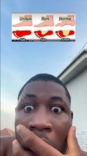 Unique, rare or normal? #cat #cutecat #cute