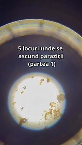 Paraziții nu sunt o poveste veche sau ceva „exotic”. Sunt mult mai comuni decât crede lumea și, de cele mai multe ori, trec complet neobservați. Paraziții nu te doboară dintr-o dată. Te macină încet. Și fix asta îi face periculoși. Dacă vrei să înțelegi de ce corpul tău nu mai funcționează cum trebuie, uneori merită să te uiți mai atent la ce se ascunde în spate #health #healthy #healthylifestyle #healthyliving #oxygen #breath #walk #nature #natural #naturalremedies #naturelovers #holistichealth