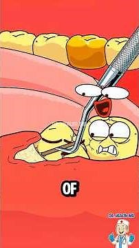 Why Dentists Won't Pull All 4 Teeth at Once! #wisdom #shorts