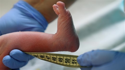 Rewriting the story of malnutrition