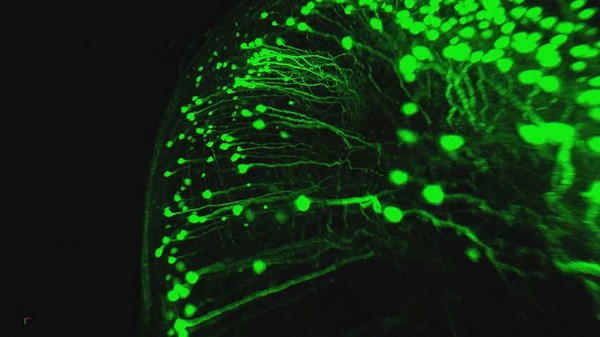 New brain cell discovered by by UBC scientists