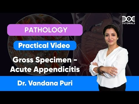 Gross Specimen – Acute Appendicitis | Pathology Practical | Dr. Vandana Puri | DocTutorials MBBS