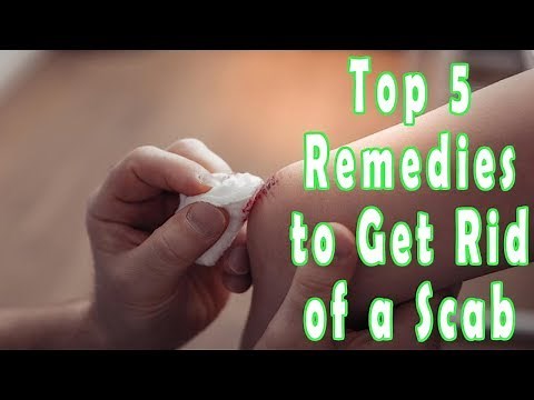 How to Get Rid of a Scab? | Top 5 Remedies to Get Rid of a Scab
