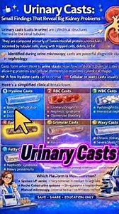 🔍 Urinary Casts: 🫘Small Under the Microscope 🔬– Big Trouble for Kidneys!🫘 #AI #X #healthcare