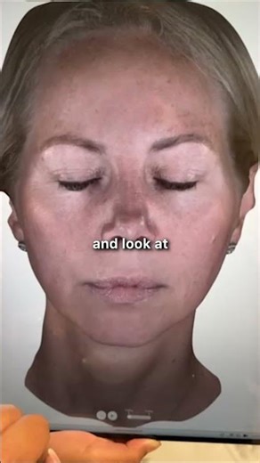 Why Are Doctors Using This AI In Clinics?