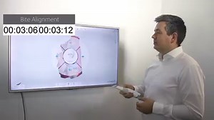 SEE TRIOS 3 WIRELESS INSANE SPEED IN ACTION Wireless scanning is insane fast! - See here! | 3Shape