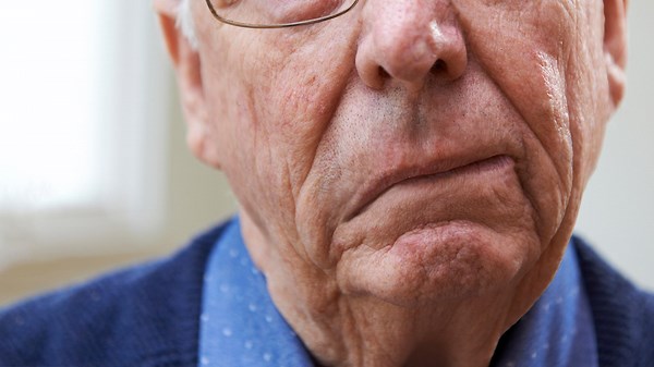 Plötzliche Gesichtslähmung: Was hilft gegen die Ursachen bei Fazialisparese?