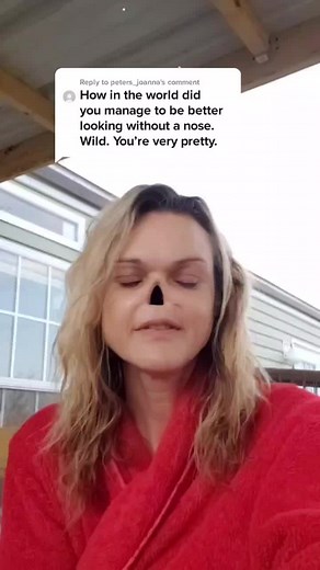 Embracing Differences: The Inspiring Story of a Woman Without a Nose