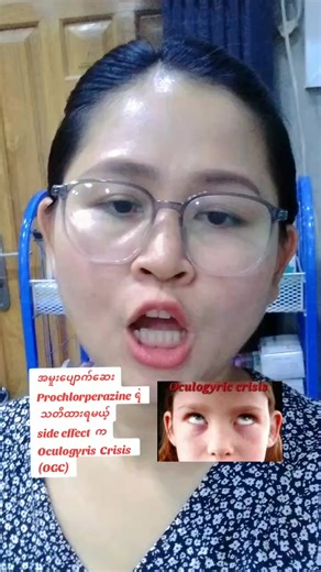 #prochlorperazine #oculogyriccrisis #sideeffects #ဖြူစင်မြတ်ဆေးခန်း #fyp