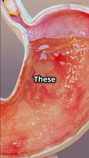 Why do farts smells so bad?