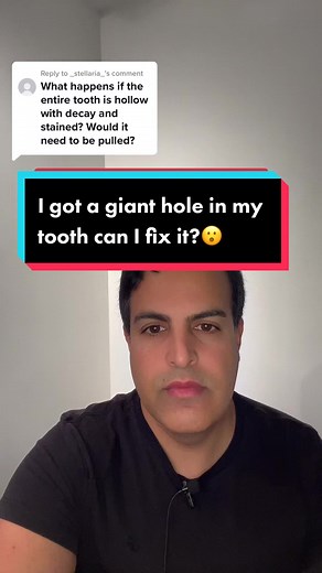 Replying to @_stellaria_ I’ve got a giant hole in my tooth can I fix it?🤯🤔#hole #tooth #Dental #Viral #FYP