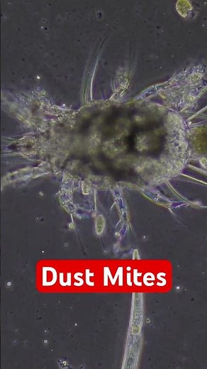 Dust Mite Under The Microscope 😲 #science #health