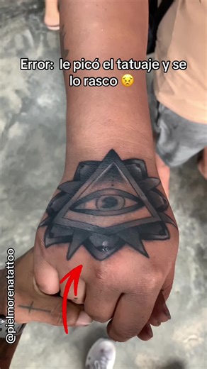 Rascándose un Tatuaje: ¿Qué Pasó? 😣