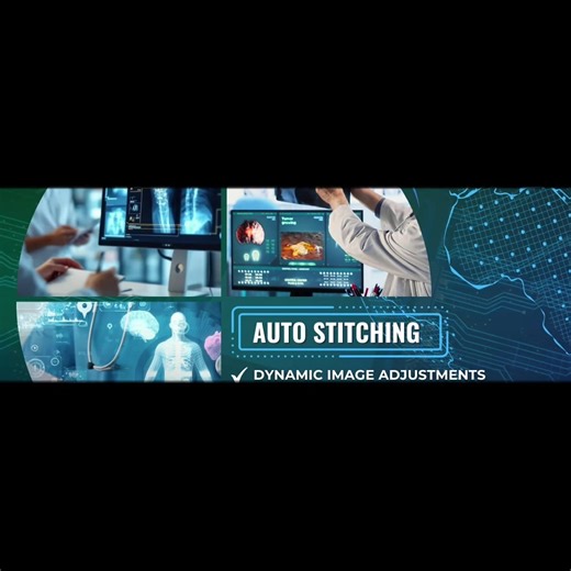 New Gen Diagnostic imaging equipment #digitalimagingxray #portablexray #handheldxray