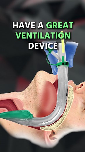 Advanced Airway Device for EMS: Eye Gel in the Field