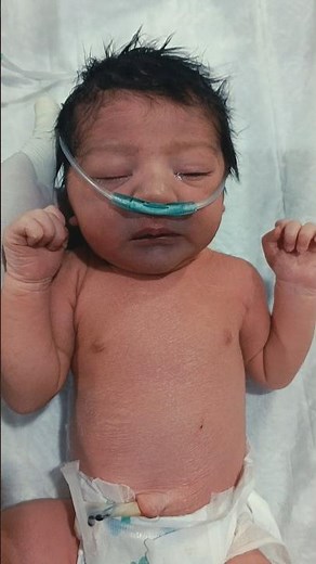 👶 Peripheral Cyanosis in Newborn Baby | Blue Hands & Feet Explained 🩺