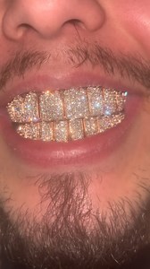453 reactions · 24 shares | 10on10 Jumbo VVS1 natural diamond on Rose Gold We offer from natural, lab-grown diamond to moissanite Get your grillz and jewelry from the real jeweler. Everything is manufactured in house  (832)-366-5783 ✅monthly payment available #grillz #diamondgrillz #customgrillz #goldgrillz #silvergrillz #rap #rapper #hiphop #hiphopculture #vvs | Agoradiant | Facebook