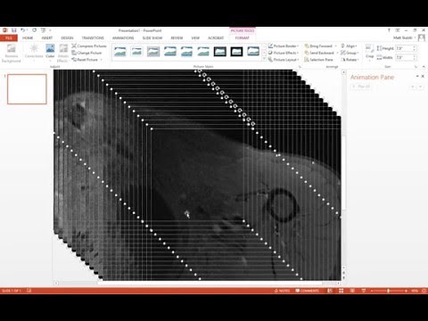 How to animate an image stack in powerpoint - radiology tutorial - MRI - CT