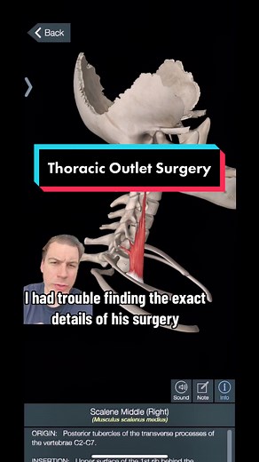 Thoracic Outlet Syndrome can be extremely complicated and when surgery is needed it either involves the first rib or these two muscles. And once you alter muscles on an elite athlete you always risk never making a full recovery. #washingtonnationals #baseballlife #baseballszn