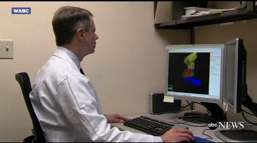 Understanding new prostate cancer screening advice