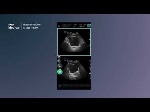 neo of 4.8 Bladder Volume measurement