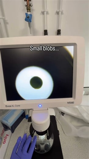 These small blobs can look magical under the microscope 🔬 #neuroscience #phd #phdstudent #stem