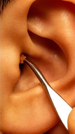 ASMR Ear cleaning, wax pull out Satisfying #asmr #satisfying #earcleaning