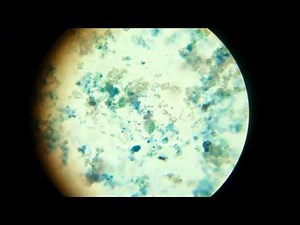 Laboratorio de Microbiología del 25/10/2013 - Vista de la bacteria en el microscopio