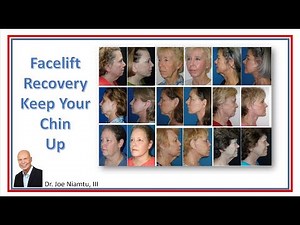 Facelift Recovery: Keep Your Chin Up!