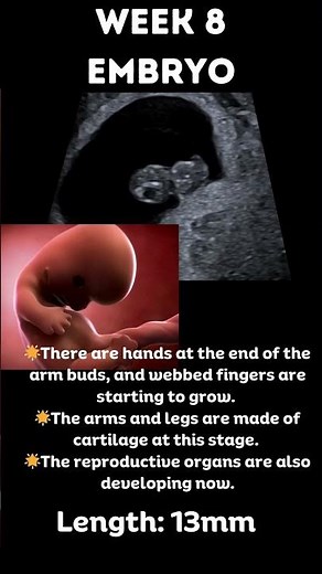 Amazing 😍Pregnancy 8 week embryo 3D animation and ultrasound #pregnancyultrasound