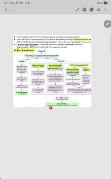 pulsus paradoxus explained in simple way