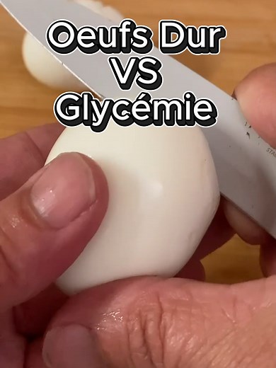 Gestion du diabète de type 2 : comprendre la glycémie