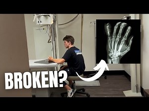 TEENAGER SLAMS FINGER IN CAR DOOR | DOCTOR VISIT AND X-RAYS TO FIND OUT | FIRST BROKEN BONE