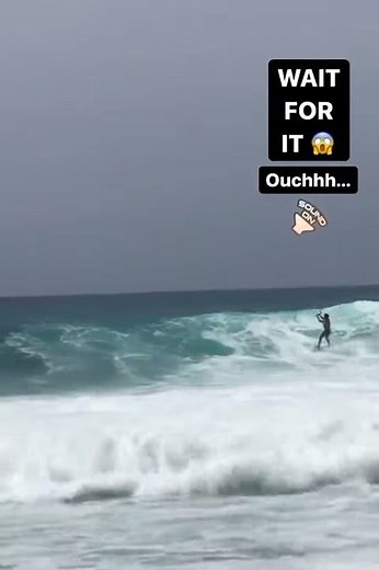 Kitesurfing accident | Kiteboard vs. Head