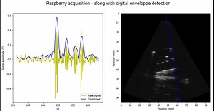 A HSDK for ultrasound imaging #piday #raspberrypi @Raspberry_Pi