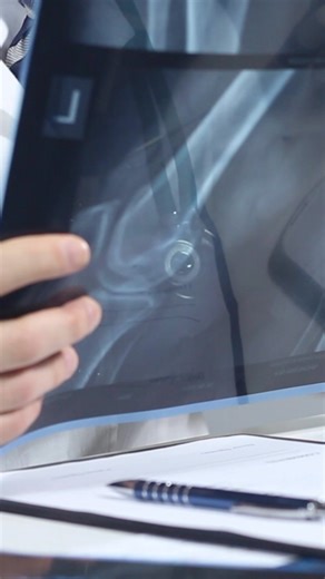 Impresión confiable para diagnósticos precisos. 嗢 La placa AGFA DRYSTAR DT2B ofrece alto contraste, excelente densidad óptica y un flujo de trabajo limpio y eficiente. ✔️ Película térmica seca ✔️ Sin químicos ni cuarto oscuro Precisión y rendimiento para tu área de imagenología. ⚙️  56 2751 5906  edmdiagnostico.com #EDM #AGFA #DRYSTARDT2B #Imagenología #RayosX #EquiposMédicos #DiagnósticoPreciso | EDM | Facebook