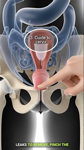 Easy Menstrual Cup Placement Guide | Step-by-Step 3D Anatomy Tutorial