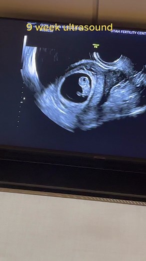 9 Week Ultrasound Reveals Baby's Development | IVF Journey