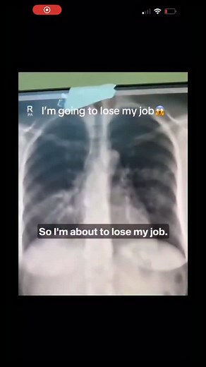 Doctors talking about applying for McDonald’s jobs due to AI was unthinkable just couple of years ago. Imagine what will happen in the next few years. Better pay off your mortgage. | Tara Shalane