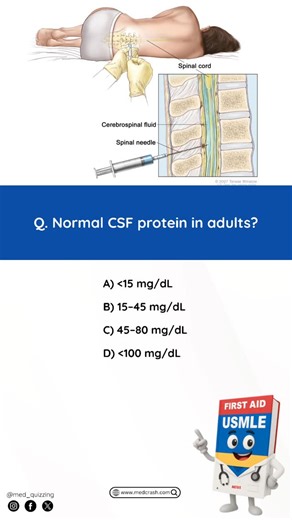 𝑴𝒆𝒅 𝑸𝒖𝒊𝒛𝒛𝒊𝒏𝒈 on Instagram: "Comment “Details” and check your inbox for the full mnemonic flashbook & flashcards! 📕✨ . . . . . . #medical #medicine #medicalstudent #medicinestudent #usmle #step1 #plab #mrcp #medicine #reels #viral #foryou #anatomy #reelexplore #instagram #neurology #nephrology #surgery #students #colleges #cardiology #knowledge #virals #plab #UK #USA #newyork #nyc #neet"