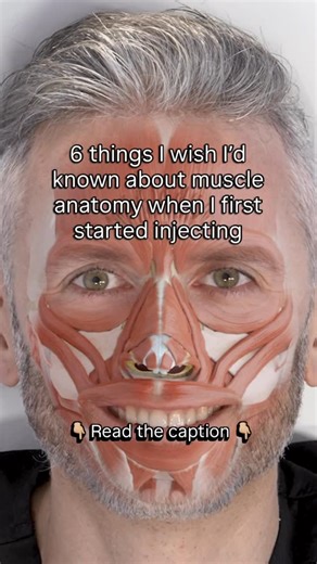 Dr Tim Pearce on Instagram: "1️⃣The frontalis is deceptively tricky It looks like a simple, flat sheet, but it’s actually thin, split into two bellies, and can move independently on each side. That’s why over-treating one section can flatten or drop brows unevenly. 2️⃣Depth matters with the corrugator The corrugator supercilii runs deep and crosses multiple planes before inserting into the dermis. Injecting too deep here risks eyelid ptosis, so knowing its layered path is critical. 3️⃣The depres