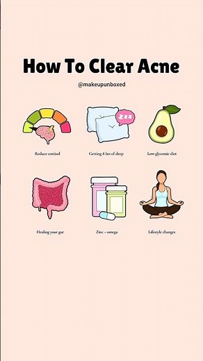 HOW TO CLEAR ACNE #acne #clearskin #skincare