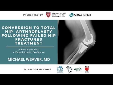 Conversion to Total Hip Arthroplasty Following Failed Hip Fracture Treatment